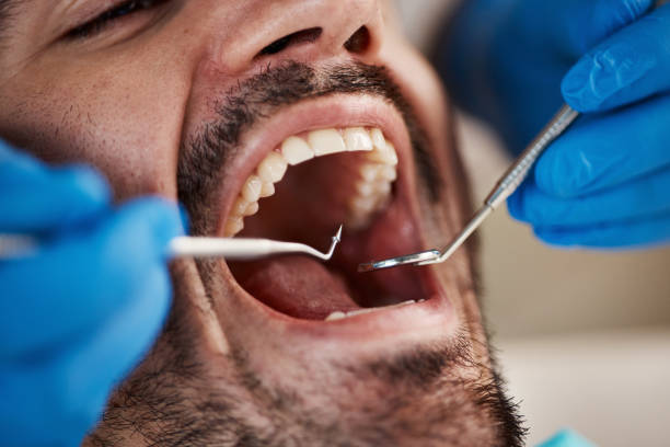 Best Walk-In Emergency Dental Services in Toledo, OH
